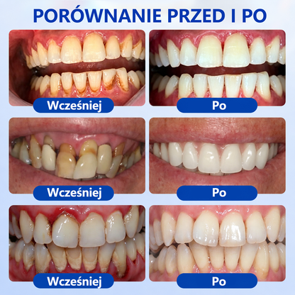 🏅🍎𝑮𝒍𝒊𝒎𝒎𝒆𝒓𝒍𝒚® 🦷 𝑮𝒖𝒎𝑹𝒆𝒗𝒊𝒗𝒆 𝒁̇𝒆𝒍 𝒅𝒐 𝑹𝒆𝒈𝒆𝒏𝒆𝒓𝒂𝒄𝒋𝒊 𝑫𝒛𝒊𝒂̨𝒔𝒆ł