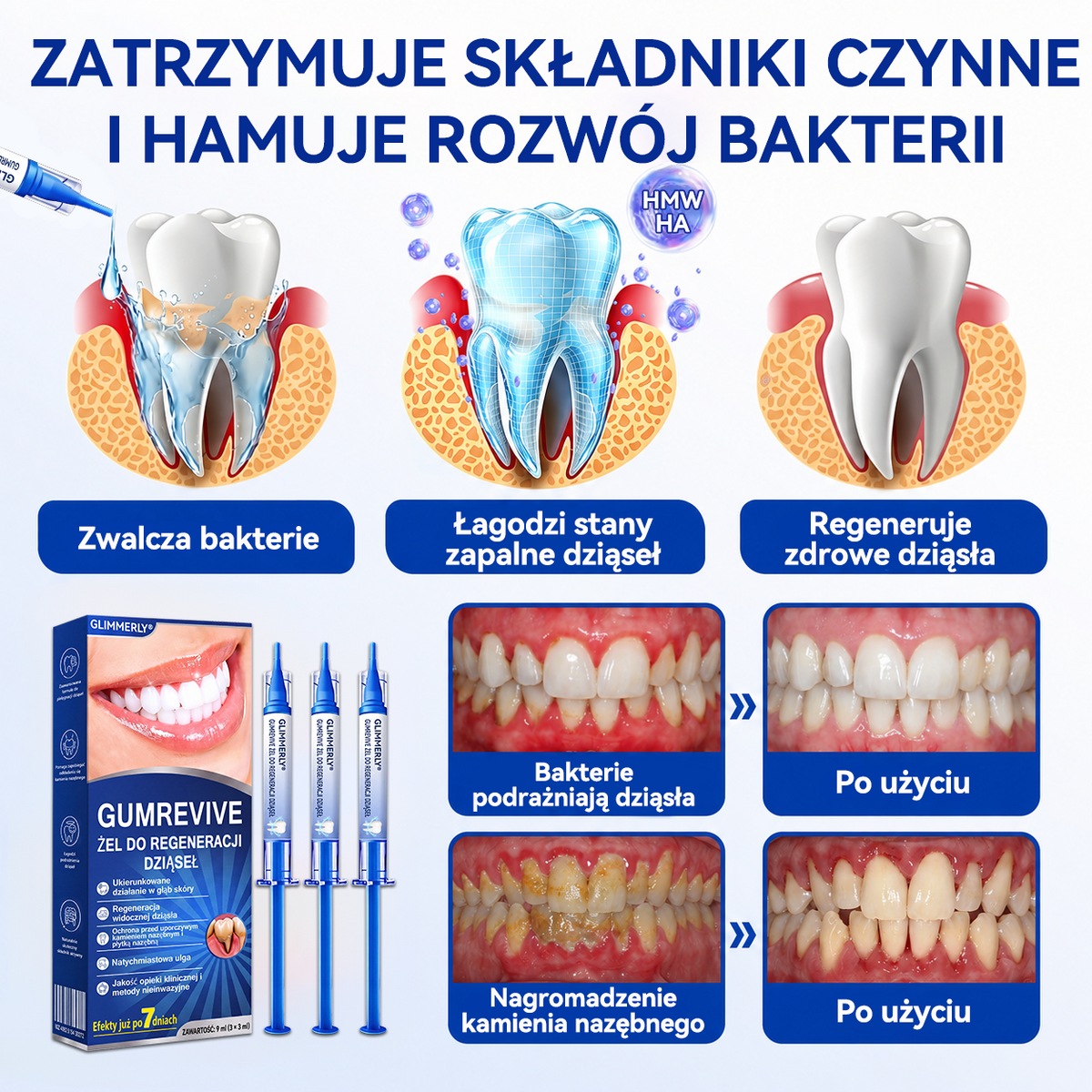 🏅🍎𝑮𝒍𝒊𝒎𝒎𝒆𝒓𝒍𝒚® 🦷 𝑮𝒖𝒎𝑹𝒆𝒗𝒊𝒗𝒆 𝒁̇𝒆𝒍 𝒅𝒐 𝑹𝒆𝒈𝒆𝒏𝒆𝒓𝒂𝒄𝒋𝒊 𝑫𝒛𝒊𝒂̨𝒔𝒆ł