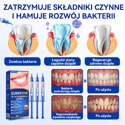 🏅🍎𝑮𝒍𝒊𝒎𝒎𝒆𝒓𝒍𝒚® 🦷 𝑮𝒖𝒎𝑹𝒆𝒗𝒊𝒗𝒆 𝒁̇𝒆𝒍 𝒅𝒐 𝑹𝒆𝒈𝒆𝒏𝒆𝒓𝒂𝒄𝒋𝒊 𝑫𝒛𝒊𝒂̨𝒔𝒆ł
