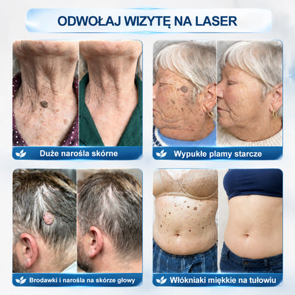 𝐏i𝐜𝐝o®🔊7 𝑫𝒏𝒊 𝑷𝒓𝒆𝒑𝒂𝒓𝒂𝒕 𝑫𝒐 𝑼𝒔𝒖𝒘𝒂𝒏𝒊𝒂 𝑾łó𝒌𝒏𝒊𝒂𝒌ó𝒘 𝑴𝒊ę𝒌𝒌𝒊𝒄𝒉 𝑰 𝑷𝒓𝒛𝒆𝒃𝒂𝒓𝒘𝒊𝒆ń(𝐁𝐞𝐳 𝐁ó𝐥𝐮, 𝐁𝐞𝐳 𝐁𝐥𝐢𝐳𝐧 – 𝐑𝐨𝐥𝐥-𝐨𝐧)
