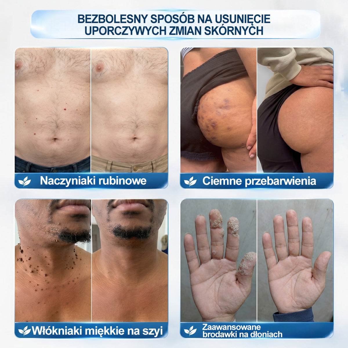 𝐏i𝐜𝐝o®🔊7 𝑫𝒏𝒊 𝑷𝒓𝒆𝒑𝒂𝒓𝒂𝒕 𝑫𝒐 𝑼𝒔𝒖𝒘𝒂𝒏𝒊𝒂 𝑾łó𝒌𝒏𝒊𝒂𝒌ó𝒘 𝑴𝒊ę𝒌𝒌𝒊𝒄𝒉 𝑰 𝑷𝒓𝒛𝒆𝒃𝒂𝒓𝒘𝒊𝒆ń(𝐁𝐞𝐳 𝐁ó𝐥𝐮, 𝐁𝐞𝐳 𝐁𝐥𝐢𝐳𝐧 – 𝐑𝐨𝐥𝐥-𝐨𝐧)