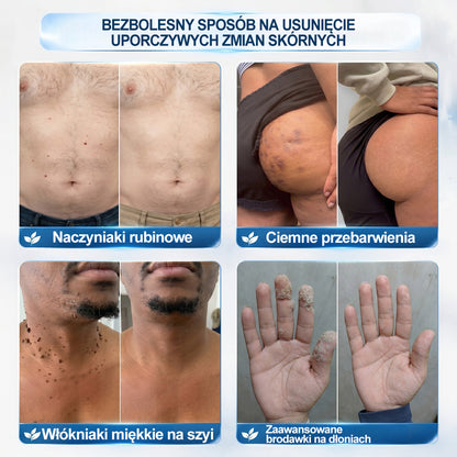 𝐏i𝐜𝐝o®🔊7 𝑫𝒏𝒊 𝑷𝒓𝒆𝒑𝒂𝒓𝒂𝒕 𝑫𝒐 𝑼𝒔𝒖𝒘𝒂𝒏𝒊𝒂 𝑾łó𝒌𝒏𝒊𝒂𝒌ó𝒘 𝑴𝒊ę𝒌𝒌𝒊𝒄𝒉 𝑰 𝑷𝒓𝒛𝒆𝒃𝒂𝒓𝒘𝒊𝒆ń(𝐁𝐞𝐳 𝐁ó𝐥𝐮, 𝐁𝐞𝐳 𝐁𝐥𝐢𝐳𝐧 – 𝐑𝐨𝐥𝐥-𝐨𝐧)