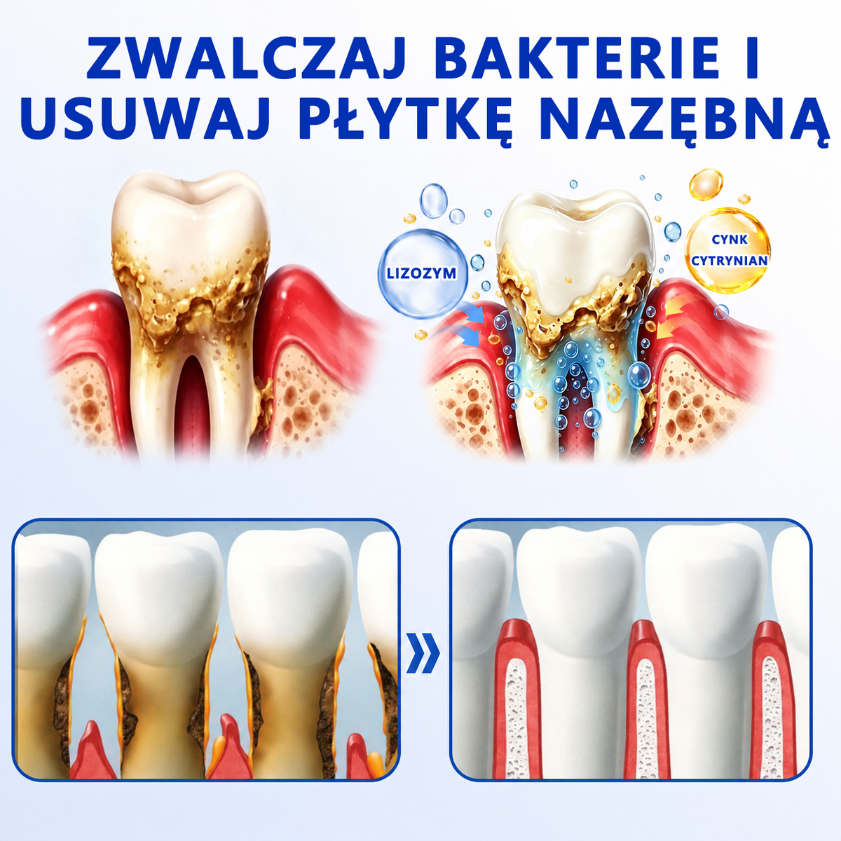 🏅🍎𝑮𝒍𝒊𝒎𝒎𝒆𝒓𝒍𝒚® 🦷 𝑮𝒖𝒎𝑹𝒆𝒗𝒊𝒗𝒆 𝒁̇𝒆𝒍 𝒅𝒐 𝑹𝒆𝒈𝒆𝒏𝒆𝒓𝒂𝒄𝒋𝒊 𝑫𝒛𝒊𝒂̨𝒔𝒆ł