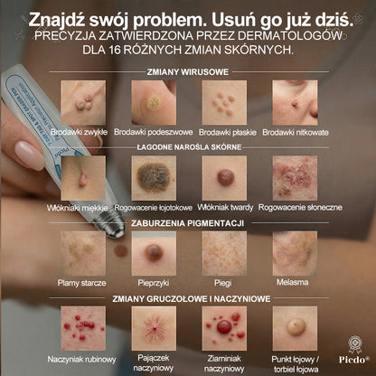 𝐏i𝐜𝐝o®🔊7 𝑫𝒏𝒊 𝑷𝒓𝒆𝒑𝒂𝒓𝒂𝒕 𝑫𝒐 𝑼𝒔𝒖𝒘𝒂𝒏𝒊𝒂 𝑾łó𝒌𝒏𝒊𝒂𝒌ó𝒘 𝑴𝒊ę𝒌𝒌𝒊𝒄𝒉 𝑰 𝑷𝒓𝒛𝒆𝒃𝒂𝒓𝒘𝒊𝒆ń(𝐁𝐞𝐳 𝐁ó𝐥𝐮, 𝐁𝐞𝐳 𝐁𝐥𝐢𝐳𝐧 – 𝐑𝐨𝐥𝐥-𝐨𝐧)