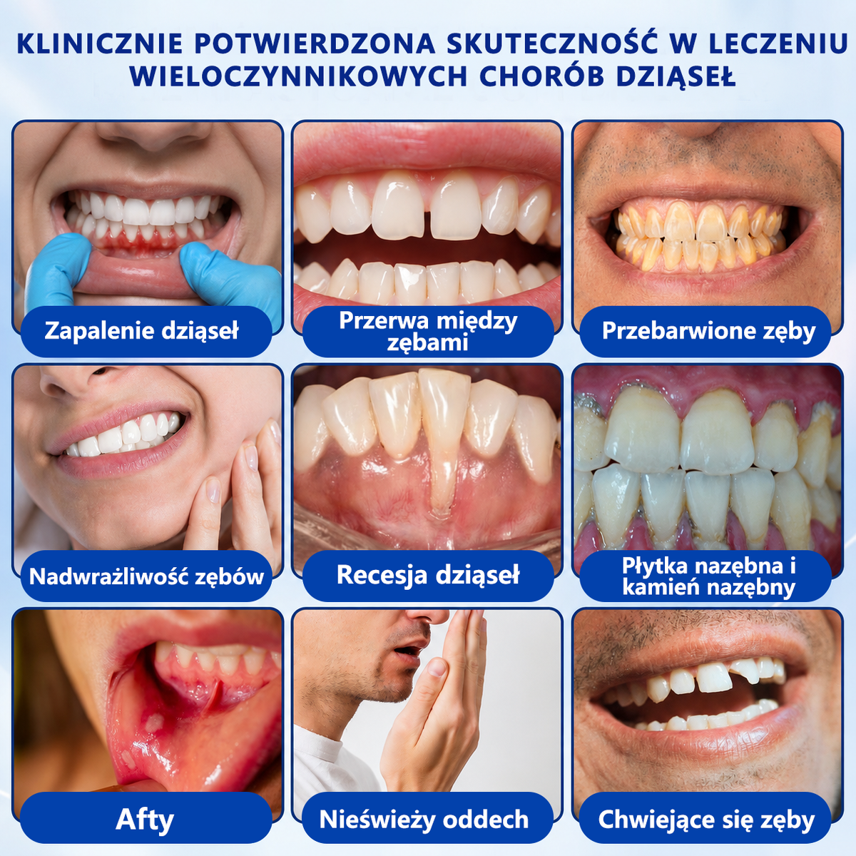 🏅🍎𝑮𝒍𝒊𝒎𝒎𝒆𝒓𝒍𝒚® 🦷 𝑮𝒖𝒎𝑹𝒆𝒗𝒊𝒗𝒆 𝒁̇𝒆𝒍 𝒅𝒐 𝑹𝒆𝒈𝒆𝒏𝒆𝒓𝒂𝒄𝒋𝒊 𝑫𝒛𝒊𝒂̨𝒔𝒆ł