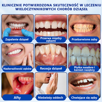 🏅🍎𝑮𝒍𝒊𝒎𝒎𝒆𝒓𝒍𝒚® 🦷 𝑮𝒖𝒎𝑹𝒆𝒗𝒊𝒗𝒆 𝒁̇𝒆𝒍 𝒅𝒐 𝑹𝒆𝒈𝒆𝒏𝒆𝒓𝒂𝒄𝒋𝒊 𝑫𝒛𝒊𝒂̨𝒔𝒆ł
