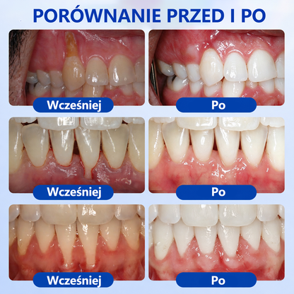 🏅🍎𝑮𝒍𝒊𝒎𝒎𝒆𝒓𝒍𝒚® 🦷 𝑮𝒖𝒎𝑹𝒆𝒗𝒊𝒗𝒆 𝒁̇𝒆𝒍 𝒅𝒐 𝑹𝒆𝒈𝒆𝒏𝒆𝒓𝒂𝒄𝒋𝒊 𝑫𝒛𝒊𝒂̨𝒔𝒆ł